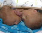 Cha mẹ từ chối tách cặp song sinh dính liền
