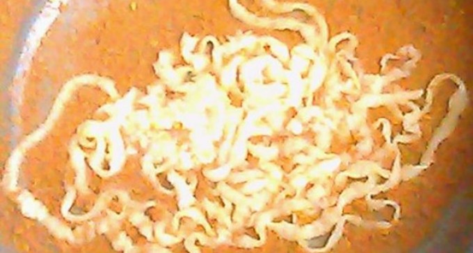 Phát hiện sán xơ mít khổng lồ trong người bệnh nhân